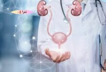 أفضل أطباء المسالك البولية في سطات
